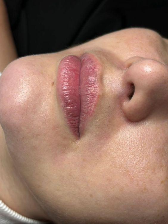 Antes — pigmentación de labios
